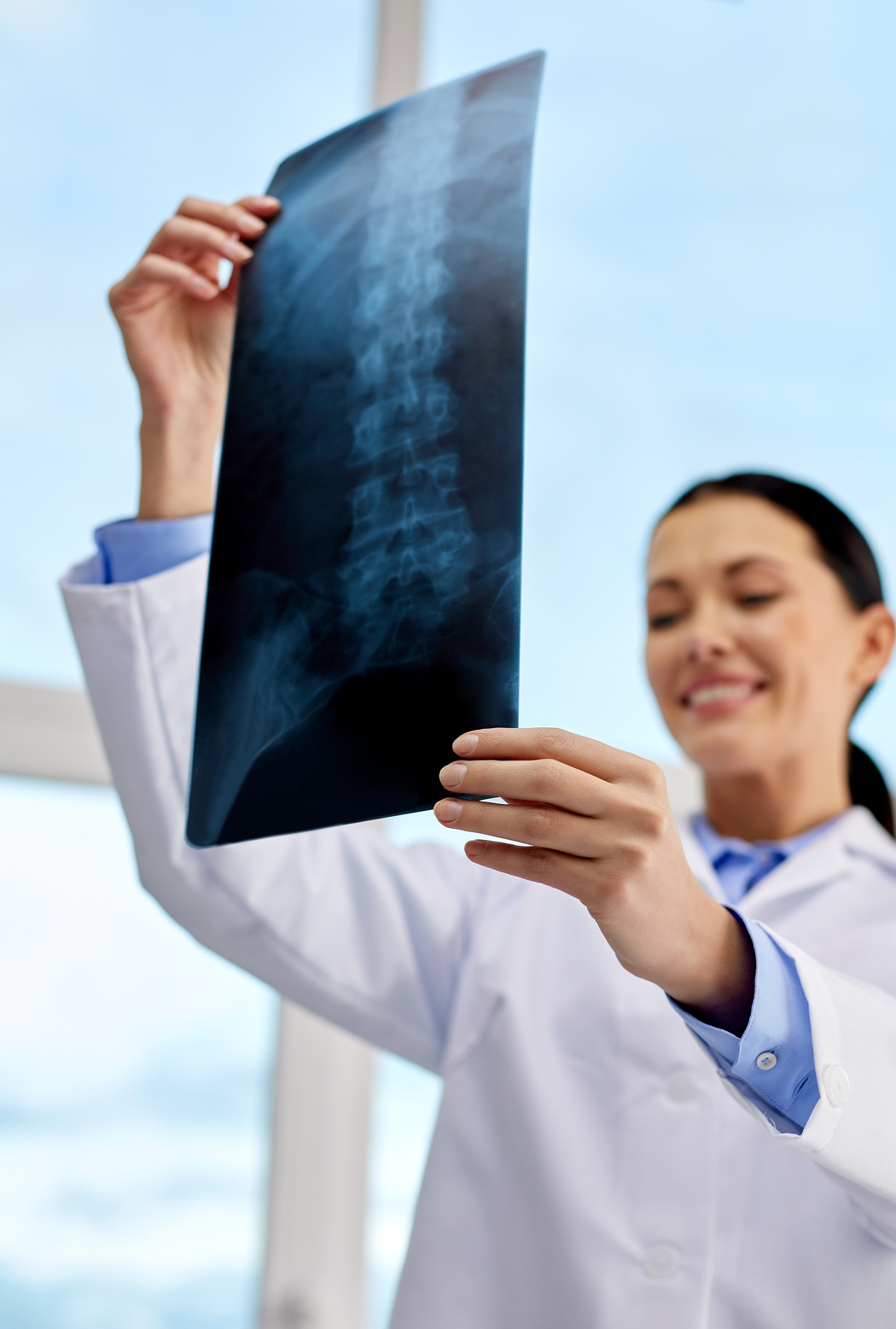 Happy Female Doctor with X-Ray at Hospital