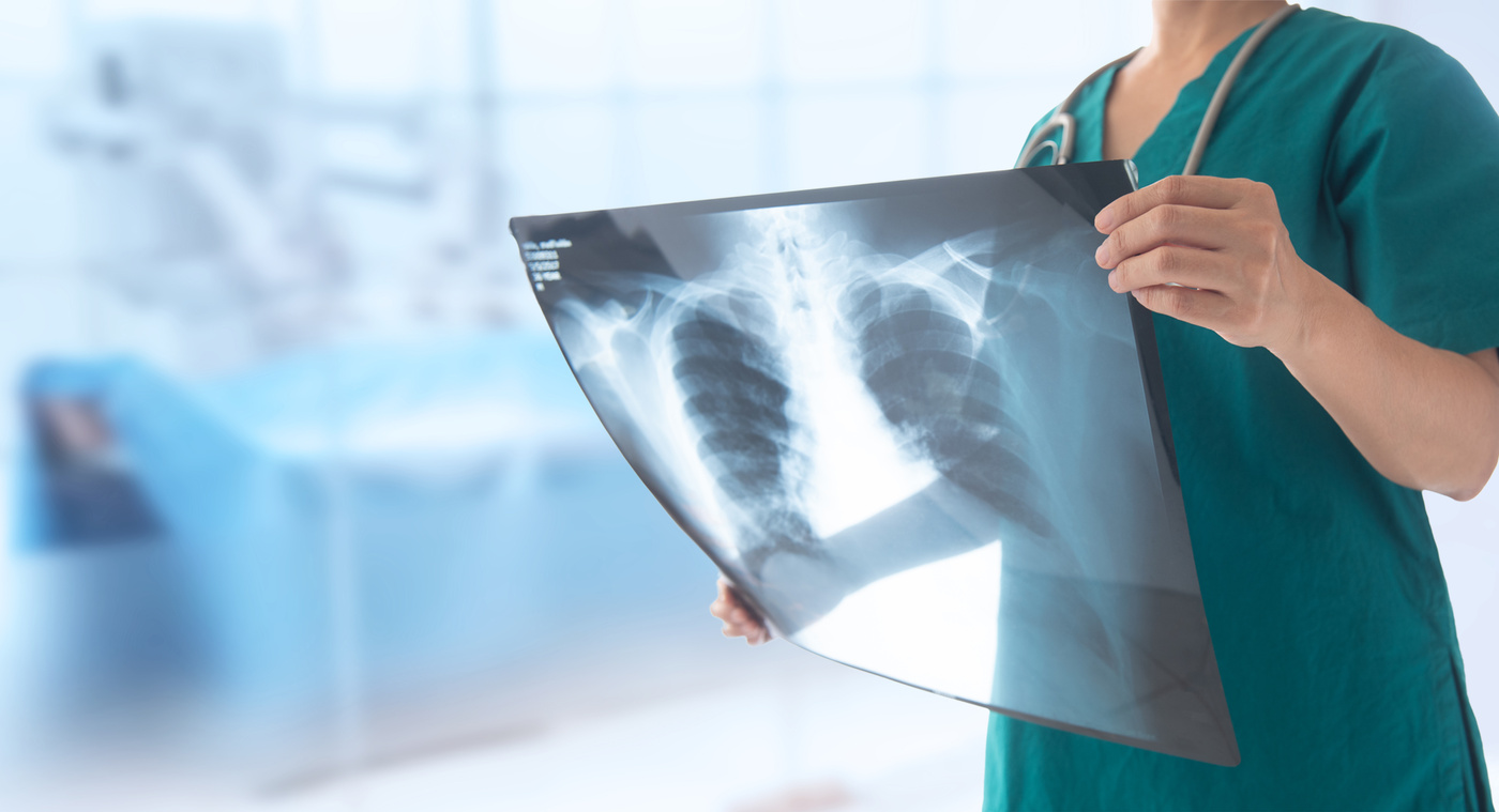 lung x-ray